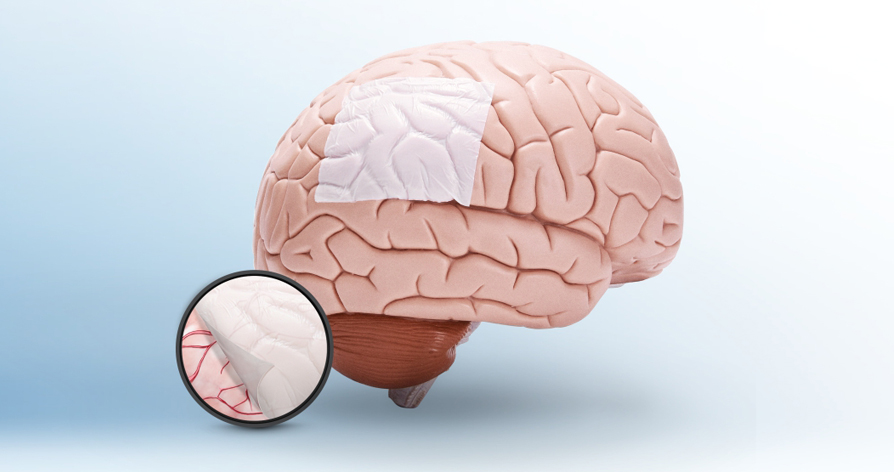 睿康?硬腦(脊)膜補片